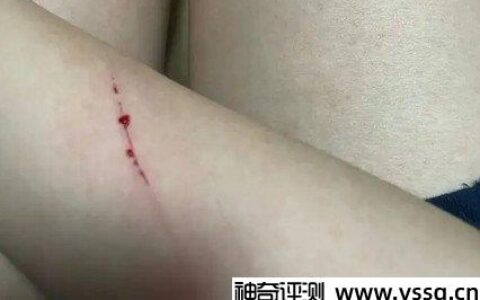 被猫抓出血了，要不要打狂犬疫苗